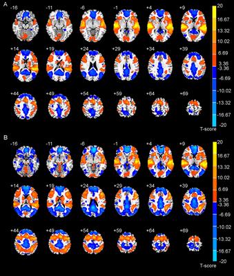 Tracking the Dynamic Functional Network Interactions During Goal-Directed Auditory Tasks by Brain State Clustering